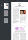 Bitemporal Alopecia: A Unique Pattern Variant of Alopecia