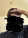 19M on Finasteride for 2 Days: Am I Showing Early Balding Signs?