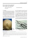 Do You Know This Syndrome? Loose Anagen Hair Syndrome in a Two-Year-Old Male Patient