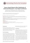 Square-Shaped Alopecia After Embolization of Intracranial Aneurysm: Case Report and Review