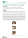 Alopecia Areata After Belimumab Use in a Patient With Systemic Lupus Erythematosus: A Paradoxical Case of Autoimmunity