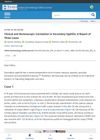 Clinical and Dermoscopic Correlation in Secondary Syphilis: A Report of Three Cases