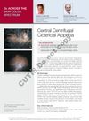 Central Centrifugal Cicatricial Alopecia