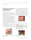 Three Orphans One Should Know: Red Scalp, Red Ear, and Red Scrotum Syndrome