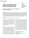 A Severe Case of Diffuse Telogen Effluvium After Endoscopic Repair of Functional Brow Ptosis