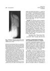 Coexistence of Angiolymphoid Hyperplasia with Eosinophilia and Pulmonary Neoplasia