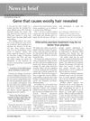 Gene That Causes Woolly Hair Revealed