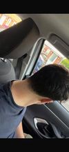I want some recommendations for good places to get hair transplant