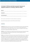 A Study of Clinical and Dermoscopic Features in Alopecia Areata at a Tertiary Referral Center