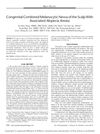 Congenital Combined Melanocytic Nevus of the Scalp With Associated Alopecia Areata