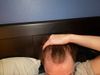 20M, Thinning for 2 Years, Can&rsquo;t Use Finasteride - What&rsquo;s Next?