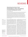Stretching the Limits: From Homeostasis to Stem Cell Plasticity in Wound Healing and Cancer