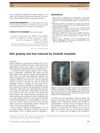 Hair Graying and Loss Induced by Imatinib Mesylate