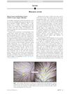 Time of Onset and Duration of Post-COVID-19 Acute Telogen Effluvium