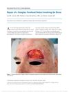 Repair of a Complex Forehead Defect Involving the Brow