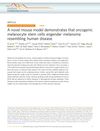 A Novel Mouse Model Demonstrates That Oncogenic Melanocyte Stem Cells Engender Melanoma Resembling Human Disease