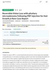 Reversible Vision Loss with Pituitary Microadenoma Following PRP Injection for Hair Growth: A Rare Case Report