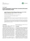 Eyelash Trichomegaly: Unusual Feature Associated With Systemic Lupus Erythematosus Patient