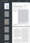 Hirsutism as the Initial Presentation of Malignant Ovarian Leydig Cell Tumor: A Case Report