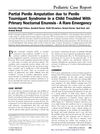 Partial Penile Amputation Due to Penile Tourniquet Syndrome in a Child With Primary Nocturnal Enuresis: A Rare Emergency