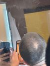 26-Year-Old Male Seeking Feedback on Crown Density After 6 Months on Minoxidil