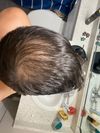 (30M) Should I start on Fin, Min or both?