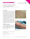 Folliculocentric Papules and Alopecia in a 70-Year-Old Woman Diagnosed with Graham-Little-Piccardi-Lassueur Syndrome
