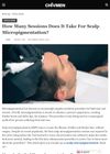 How Many Sessions Are Required for Scalp Micropigmentation