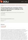 Ovarian Hyperthecosis Coexisting with an Incidental Adrenal Lesion: Challenges in the Diagnostic Approach