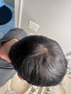 42M with Crown Thinning After 10 Years on Fin: Add Minox or Switch to Dut?