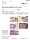 Fractional-Assisted Drug Delivery Performed with Erbium YAG Laser in Androgenic Alopecia: Histological Aspects