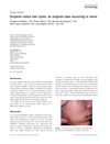 Eruptive Vellus Hair Cysts: An Original Case Occurring in Twins