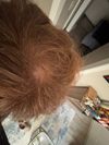 How cooked am I and should I jump on meds?