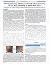 A Side-By-Side Study of 20 Consecutive FUE Patients Comparing the Use of a 0.9mm Sharp vs. 0.9mm Blunt Punch