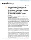Epithelial Loss of Mitochondrial Oxidative Phosphorylation Leads to Disturbed Enamel and Impaired Dentin Matrix Formation in Postnatal Developed Mouse Incisor