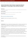 Severe Hirsutism in Non-Classic Congenital Adrenal Hyperplasia: A Case Report and Literature Review