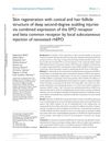 Skin Regeneration with Conical and Hair Follicle Structure of Deep Second-Degree Scalding Injuries via Combined Expression of the EPO Receptor and Beta Common Receptor by Local Subcutaneous Injection of Nanosized rhEPO