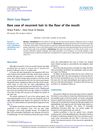 Rare Case of Recurrent Hair in the Floor of the Mouth