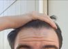 Does my hairline look different between these two photos?