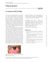 An Unusual Eyelid Swelling