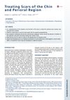 Treating Scars of the Chin and Perioral Region