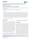Plica Polonica: Trichoscopic Findings with a Brief Literature Review