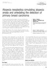 Alopecia Neoplastica Simulating Alopecia Areata and Predating the Detection of Primary Breast Carcinoma