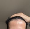 21M - Shedding a lot, thinning?