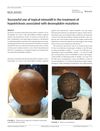 Successful Use of Topical Minoxidil in the Treatment of Hypotrichosis Associated with Desmoplakin Mutations