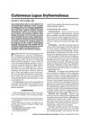 Cutaneous Lupus Erythematosus: A Comprehensive Review