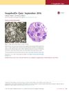 SnapshotDx Quiz: September 2016