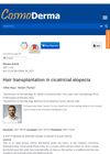 Hair Transplantation in Cicatricial Alopecia