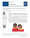Mirror-Image Alopecia Areata in Mirror-Image Twins