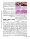 Development of Squamous Cell Carcinoma from Erythroplasia of Queyrat Following Photodynamic Therapy